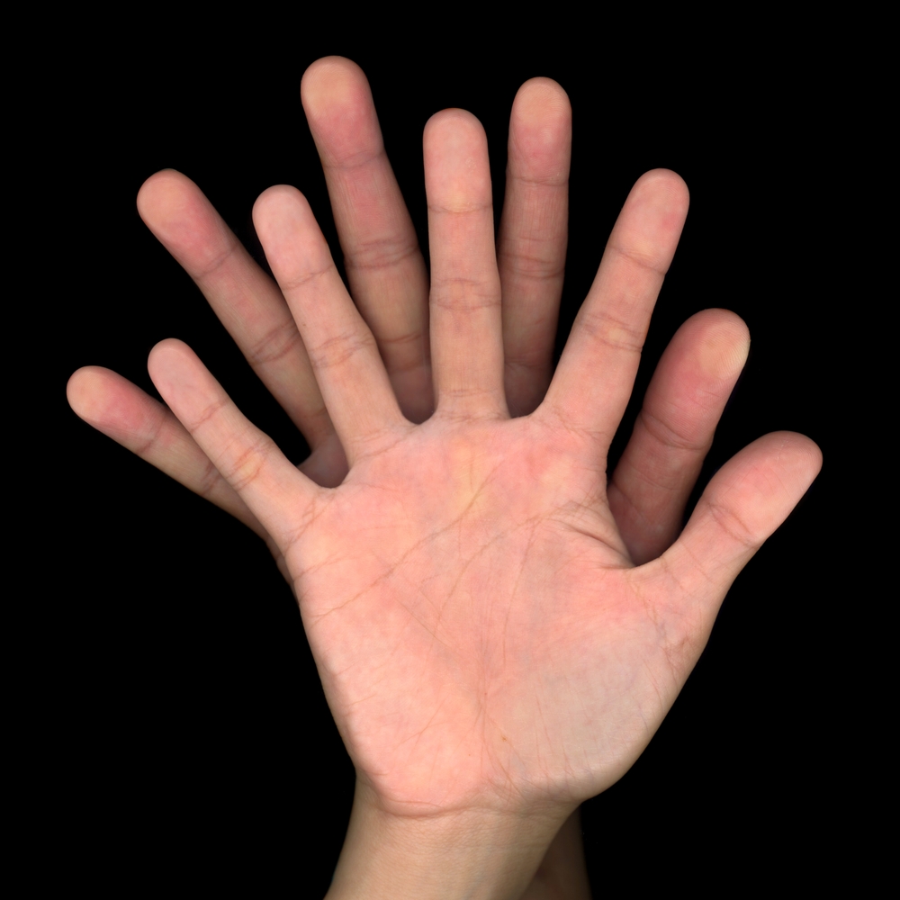 When data exposure and ransomware become one risk